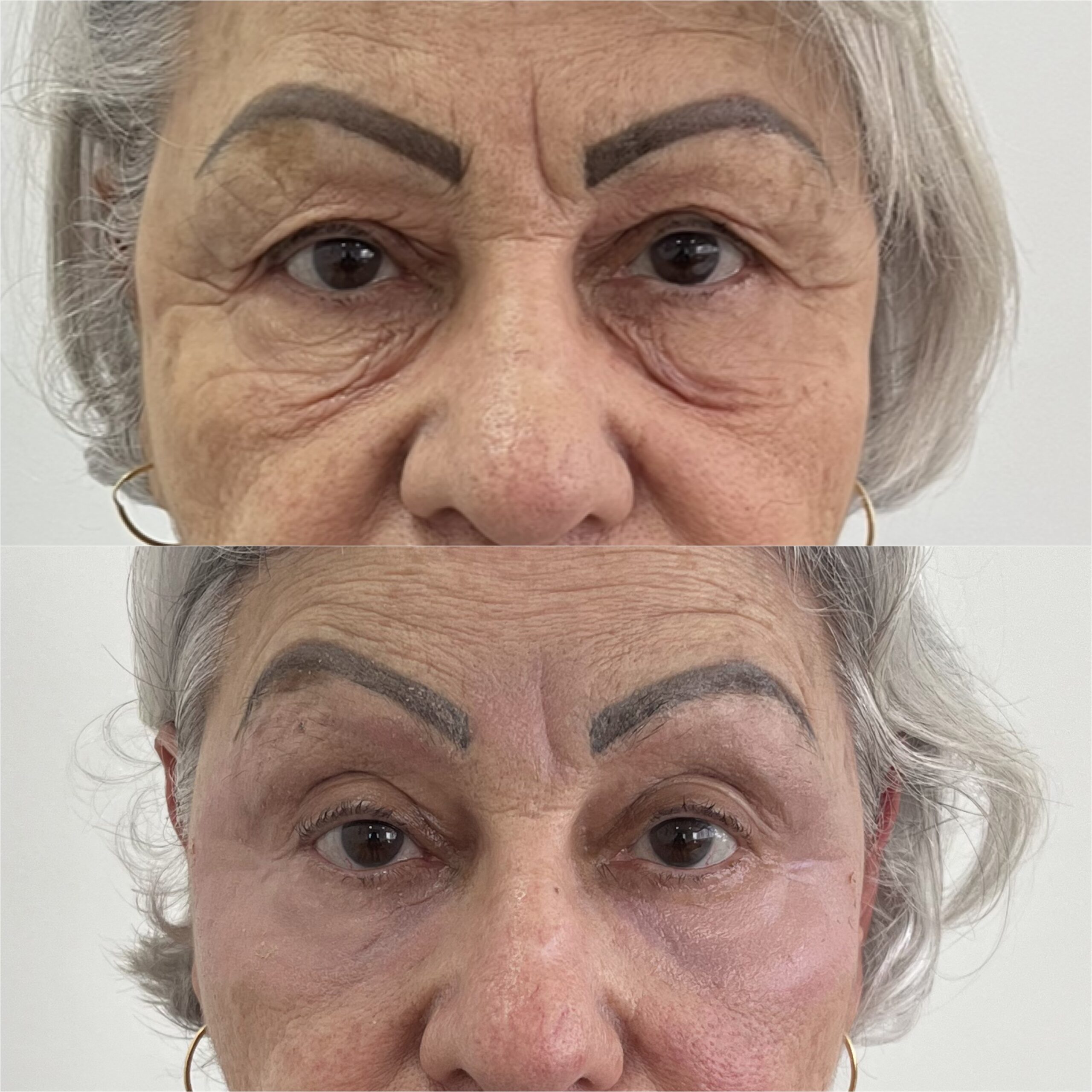 Profissional avaliando as proporções do rosto de uma paciente na Clínica Sensitivity, em Osasco