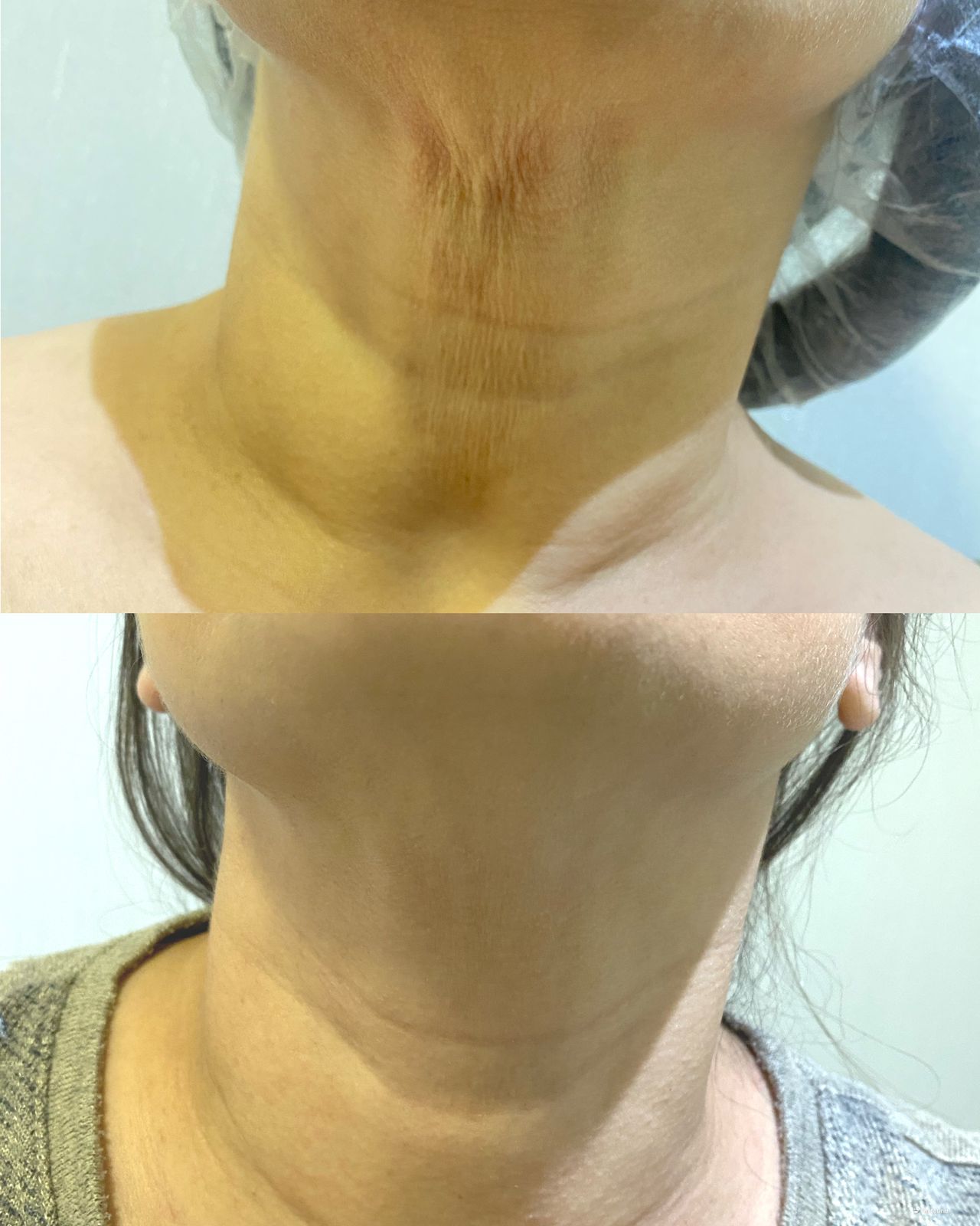 Antes e Depois 5