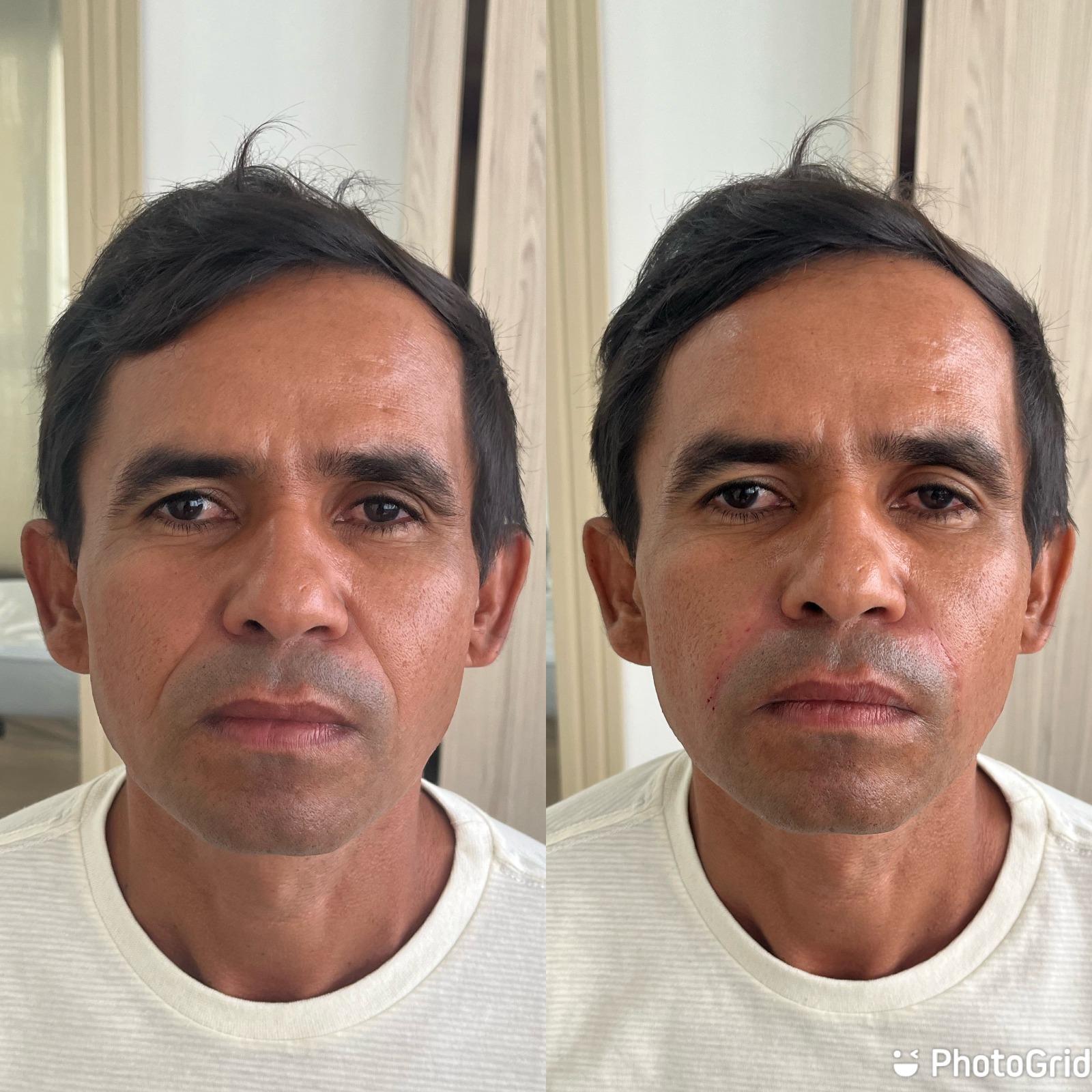 Transformação Bigode Chinês 5